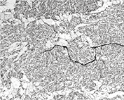 Schematic of replica method